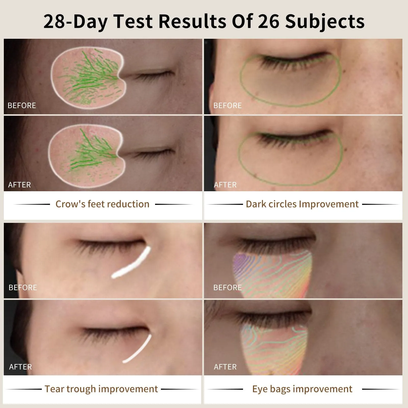 AMIRO Eye Rejuvenation RF Device