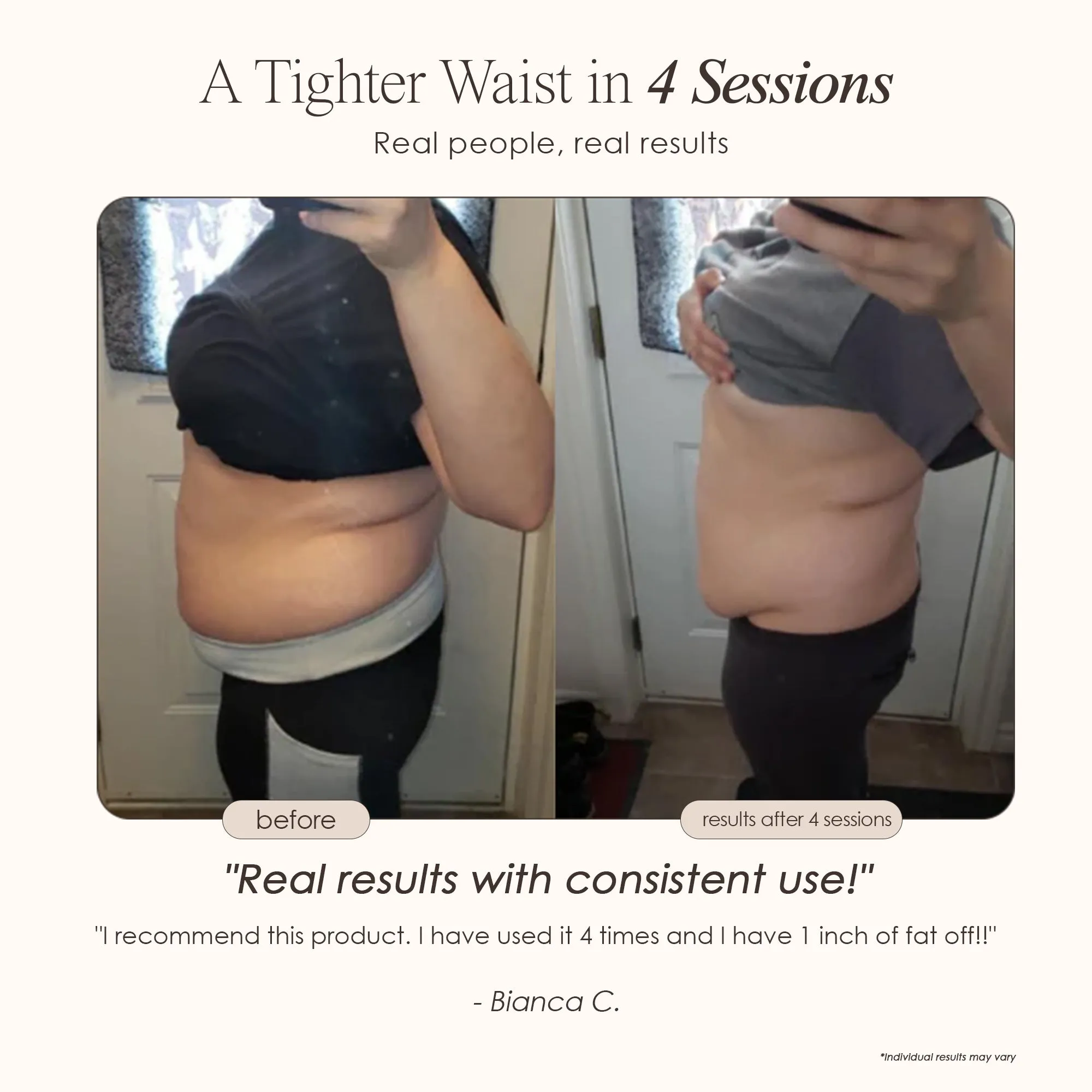 BodySculpt | LED RF Beauty System