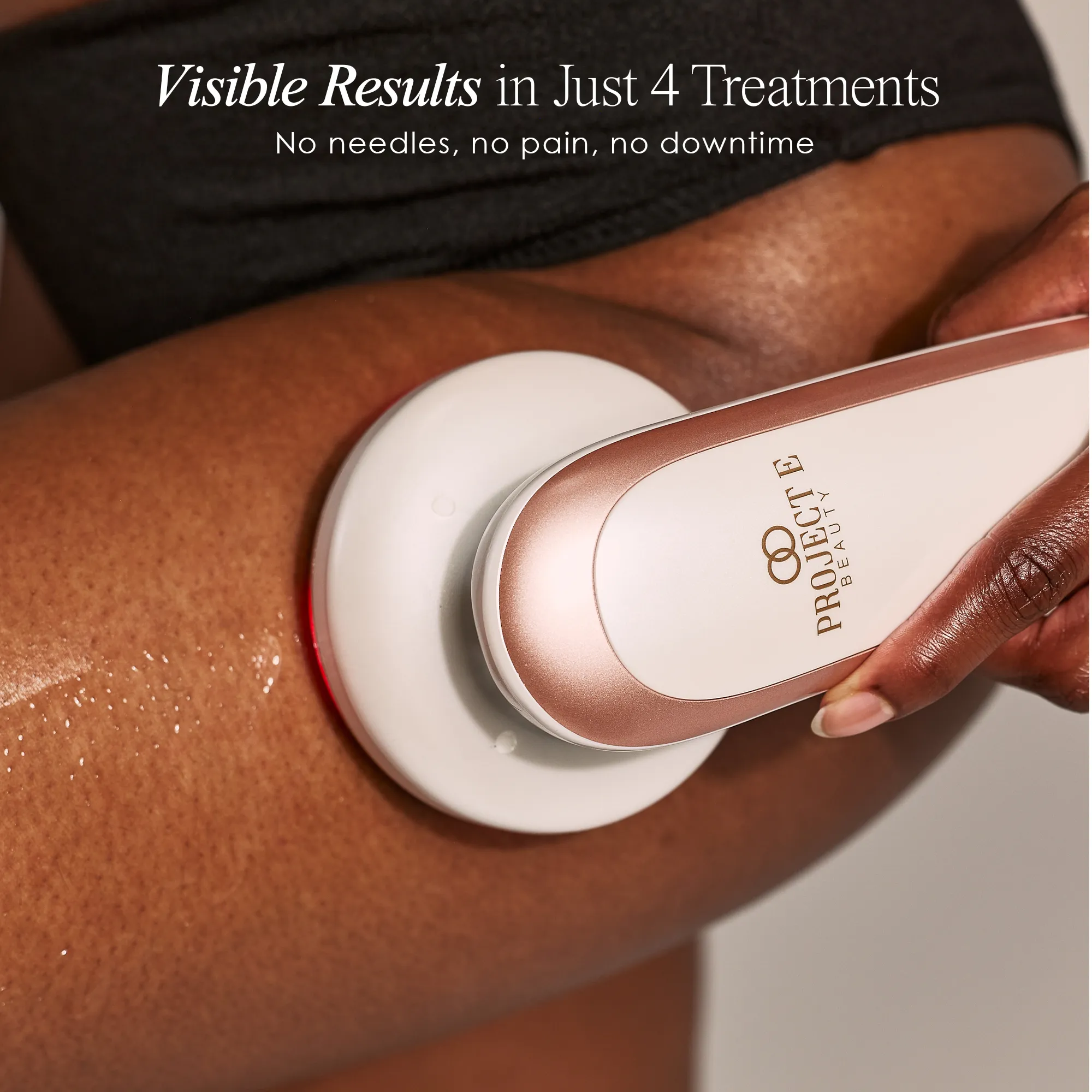 BodySculpt | LED RF Beauty System