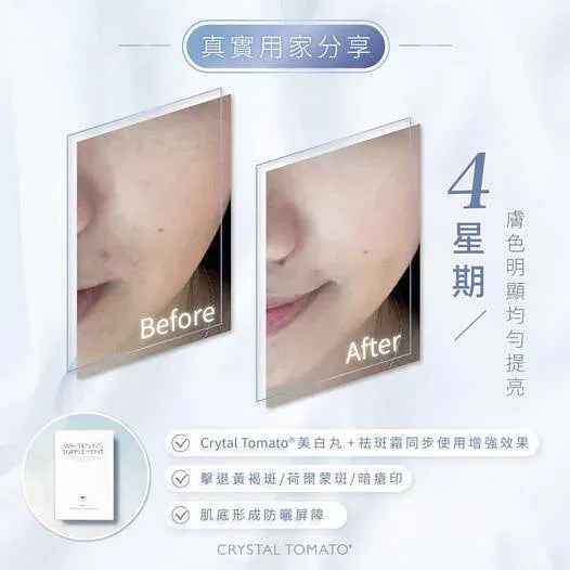 Crystal Tomato Whitening Supplement (30caps/box)