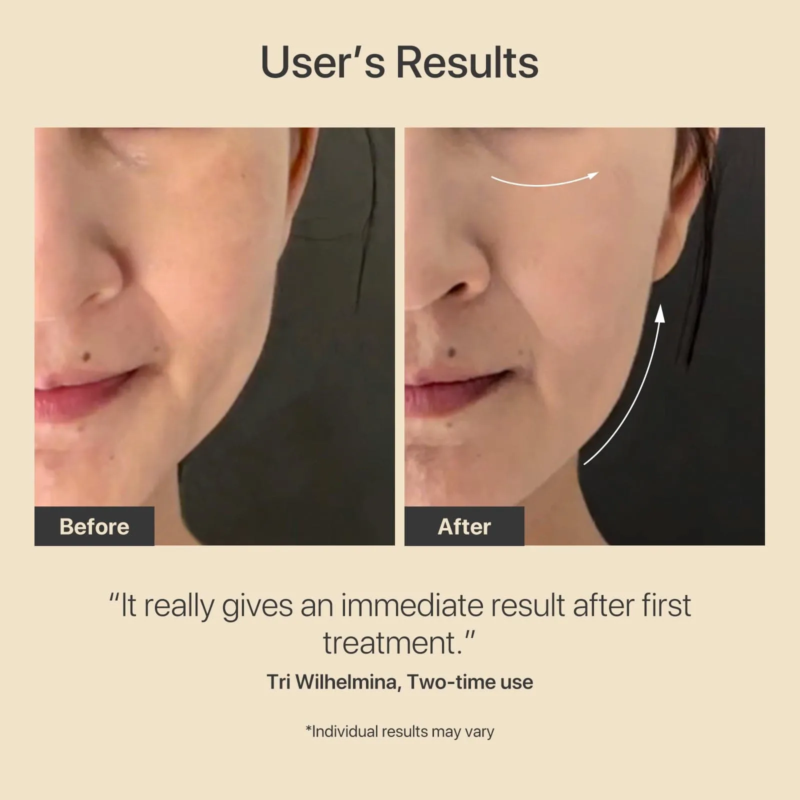 [DMAU Exclusive] R3 Turbo  Spectra Light Therapy Mask