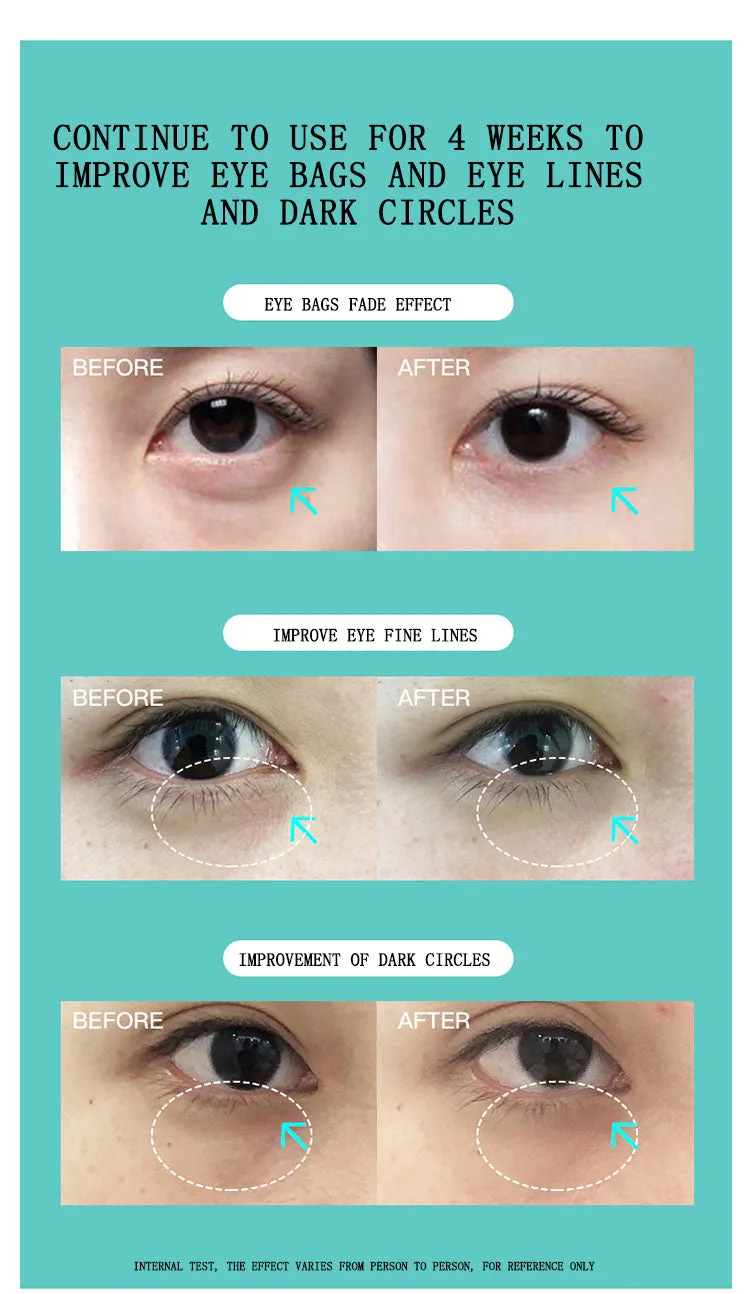 JUJY Pro iHero Eyes Care Massager