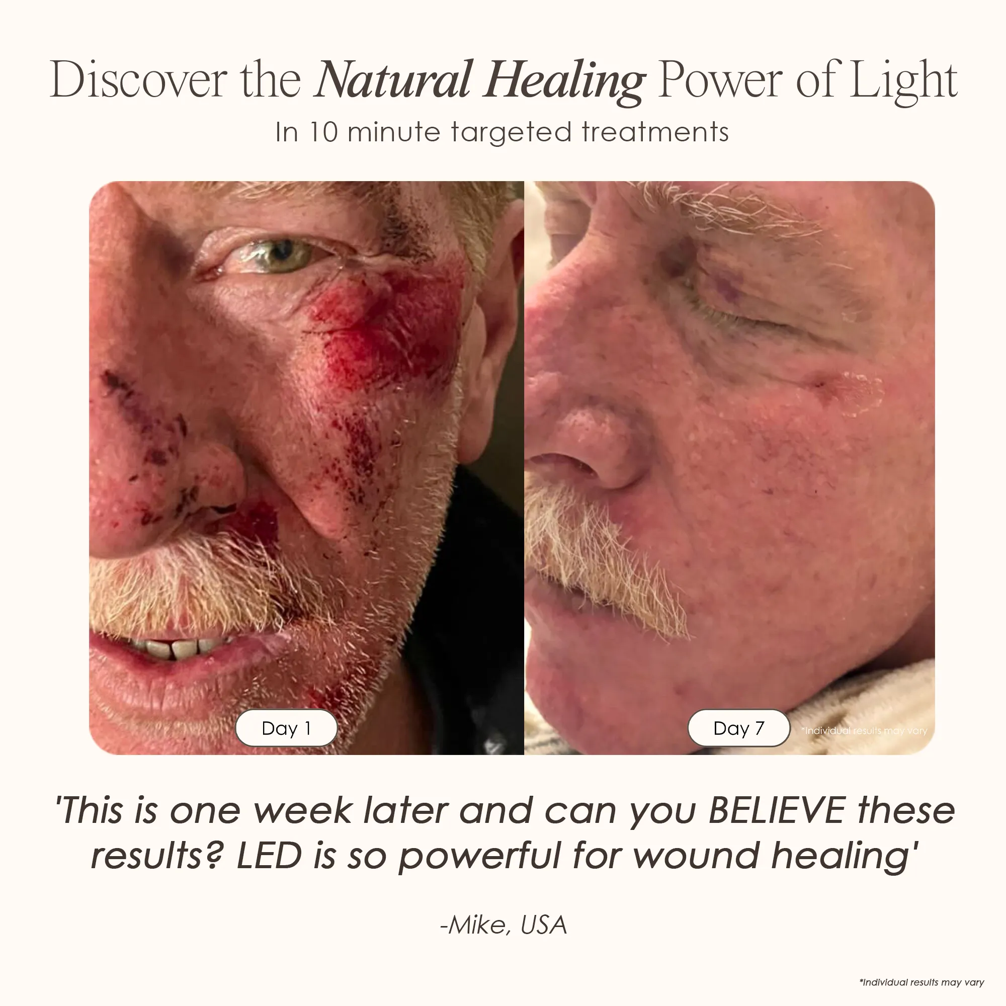 LumaLux Dome | Face & Body LED Light Therapy Device