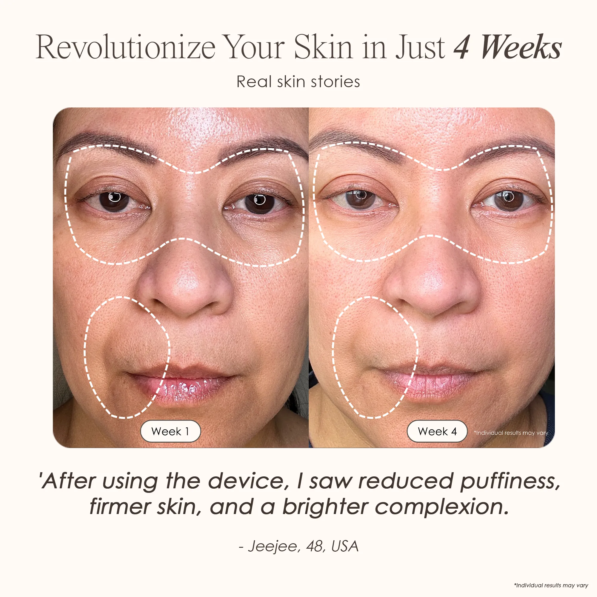 LumaLux Face | Pro LED Light Therapy Mask