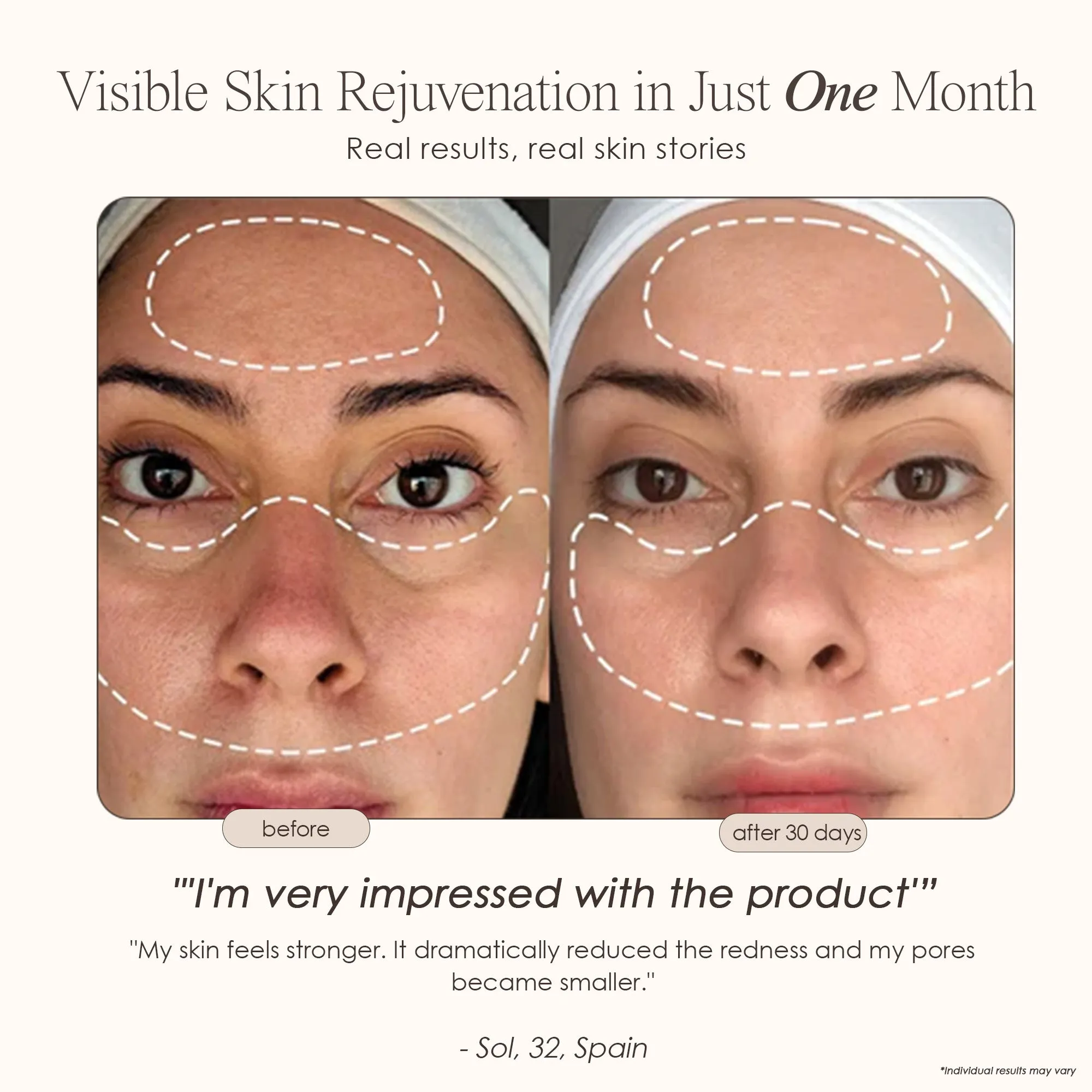 Lumamask Pro | LED Light Therapy Face Mask