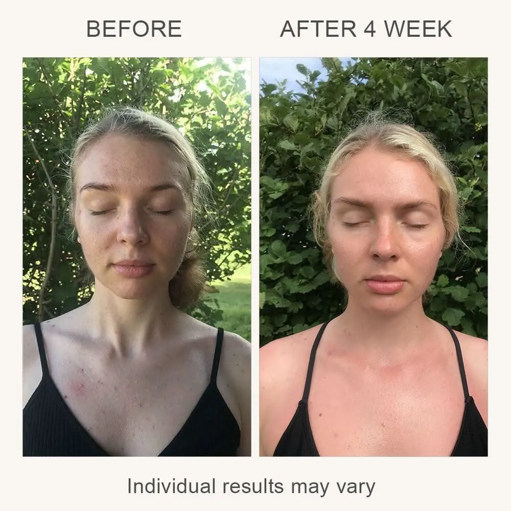 LUMI LED Light Therapy Skincare Mask