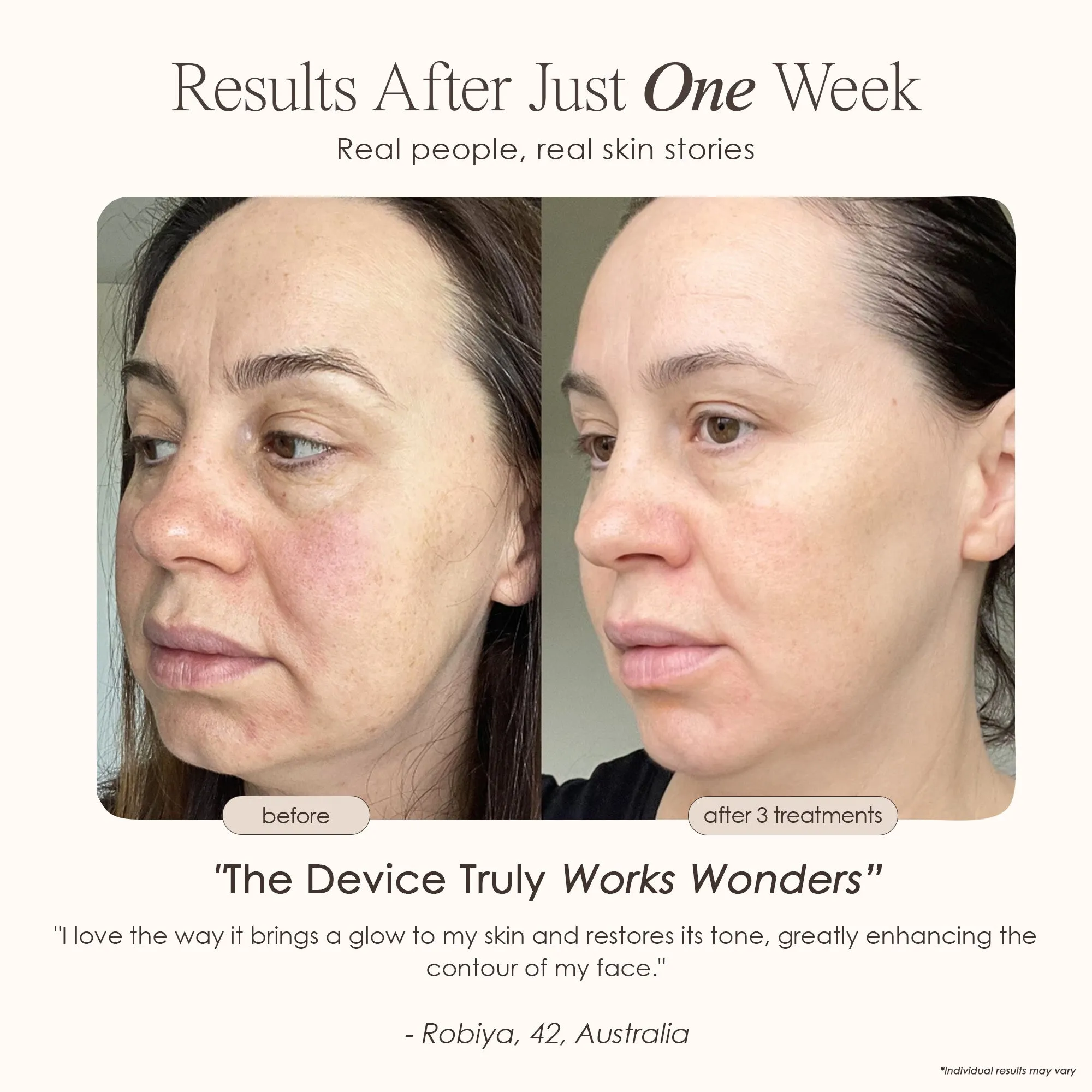 REVA | Instant Age Renewal Wand