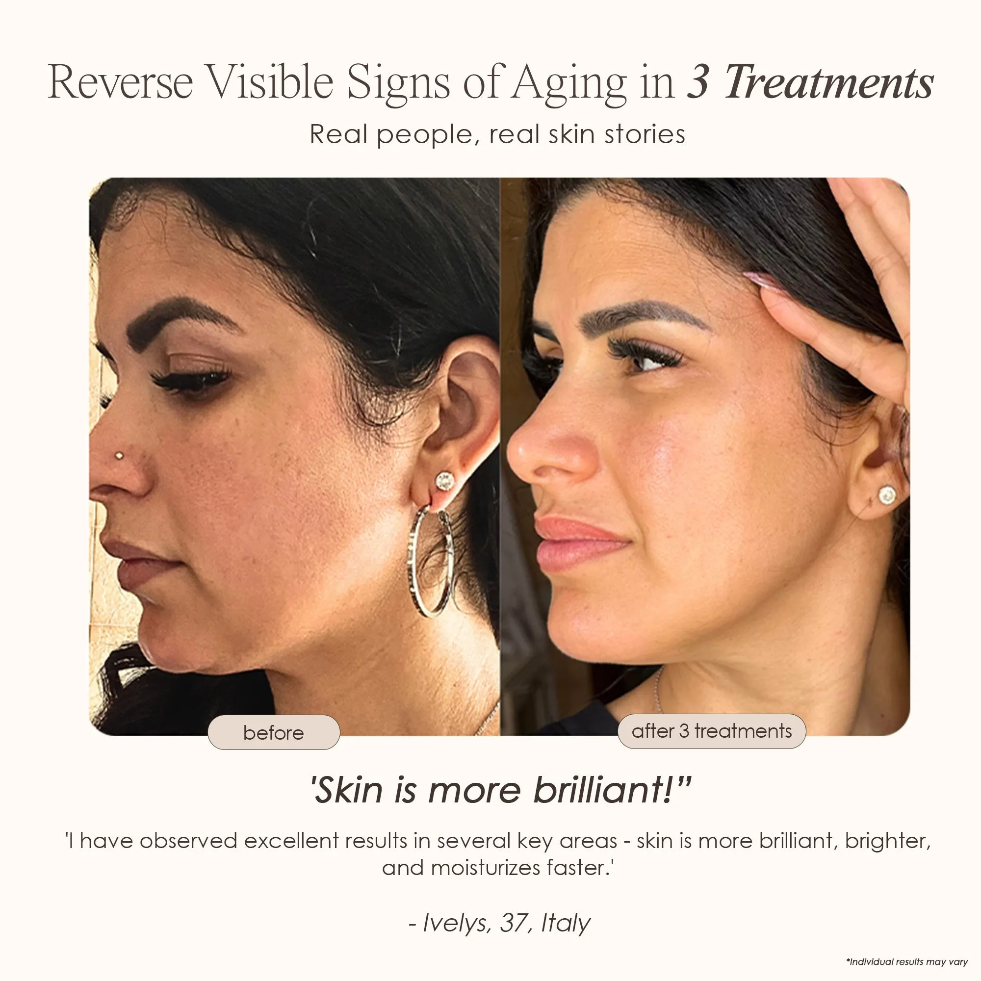 REVA | Instant Age Renewal Wand