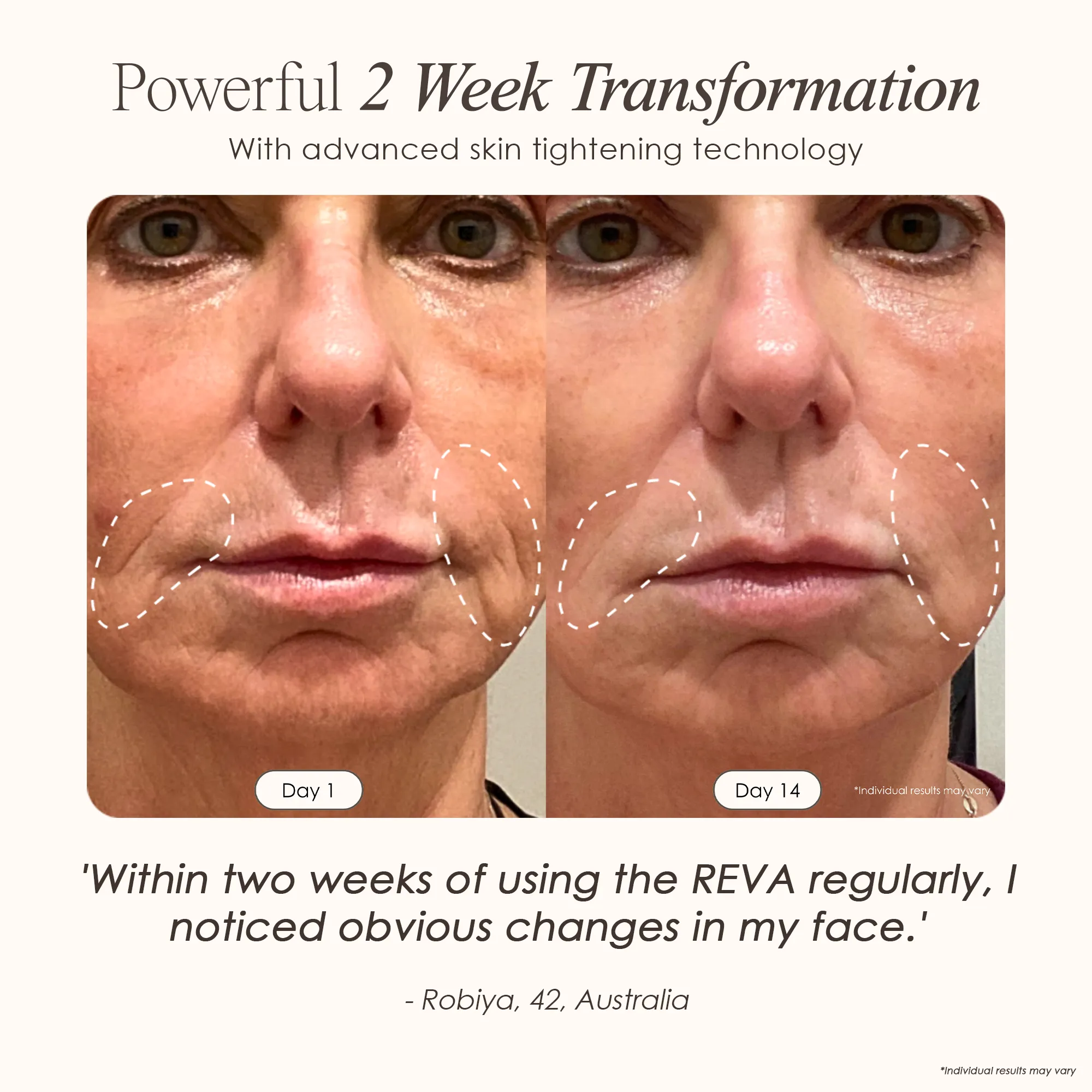 REVA | Instant Age Renewal Wand