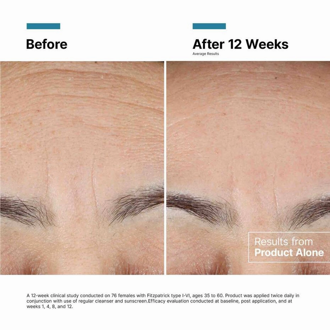 SkinCeuticals Advanced RGN-6