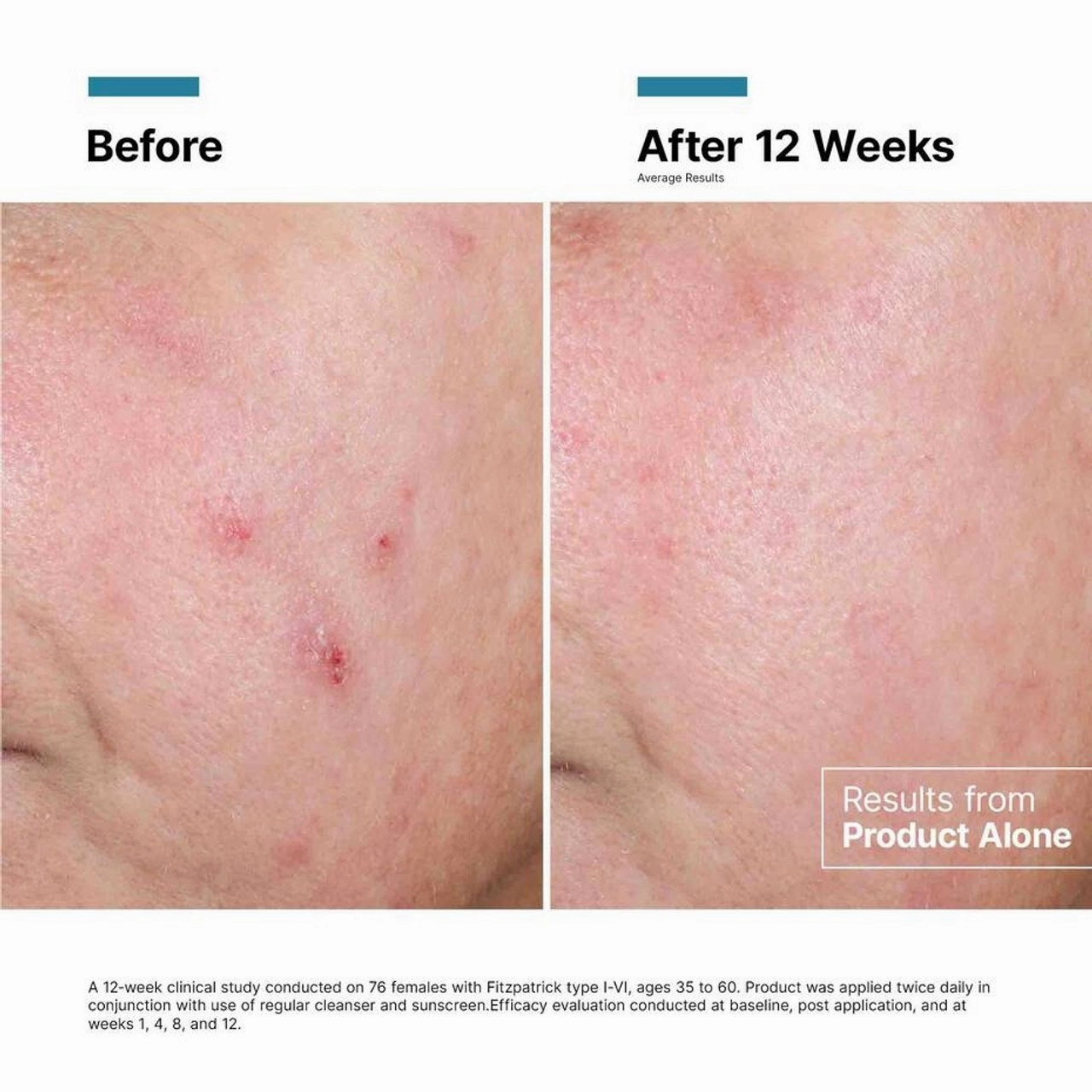 SkinCeuticals Advanced RGN-6