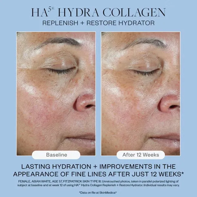 SkinMedica HA5 Hydra Collagen Replenish   Restore Hydrator